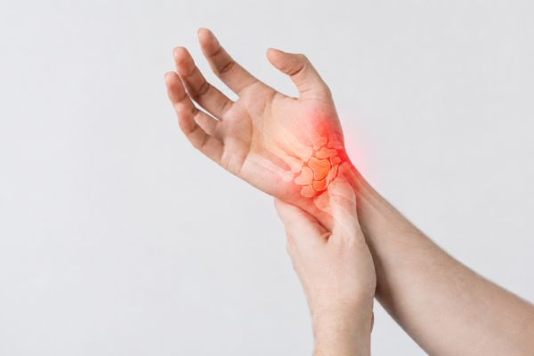 Carpal-tunnel- syndrome