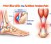 Heel Bursitis vs Achilles Tendon Pain