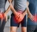 Hip Pain vs Groin Pain vs Lower Back Pain